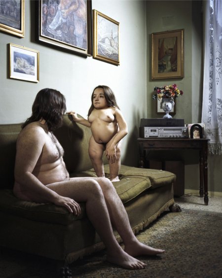 Голые женщины с отклонениями