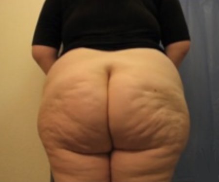 Торчащие целлюлитные задницы