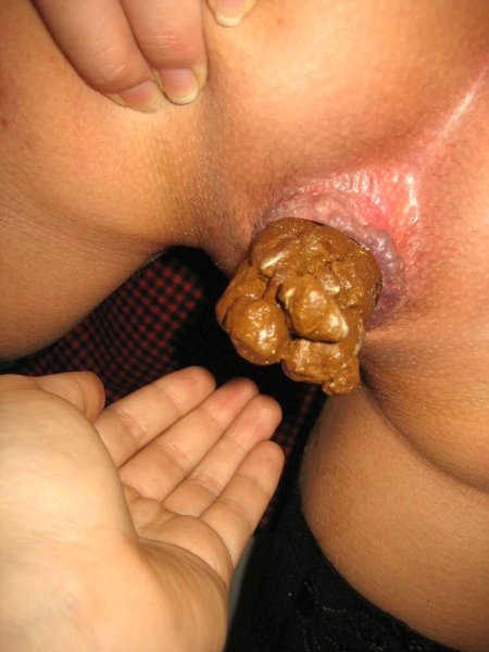 Анальное отверстие с какашкой