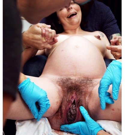 Женская вагина после родов