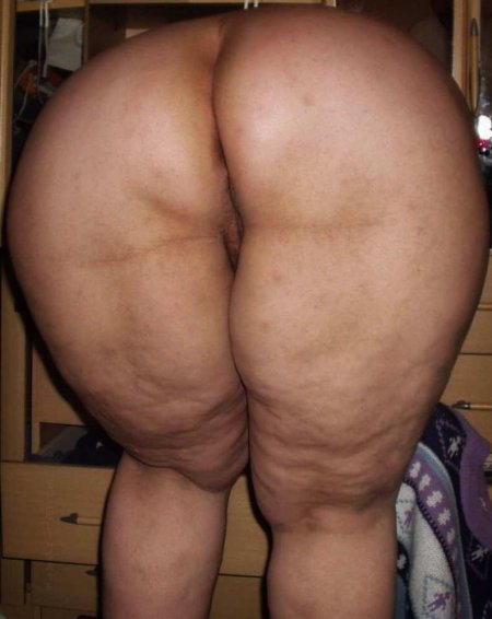Жирные целлюлитные задницы
