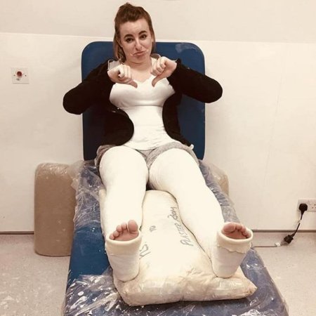 Женщина полностью в гипсе