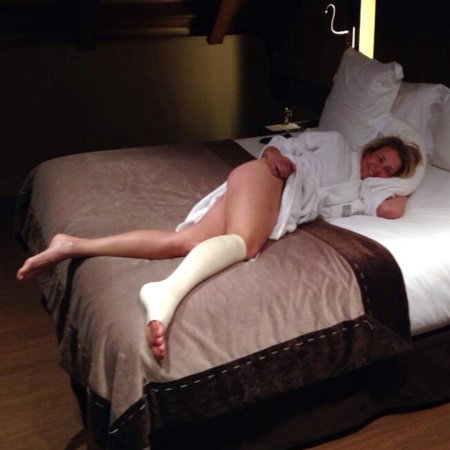 Зрелая голая в гипсе домашнее фото