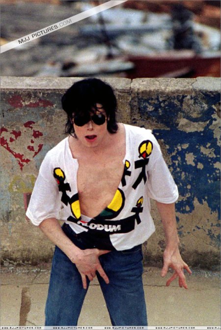 Майкл Джексон витилиго