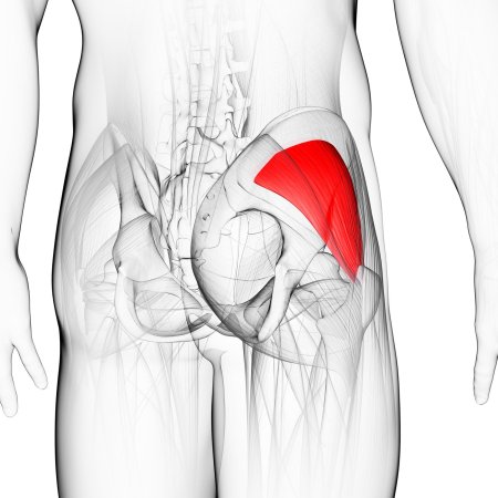 Уплотнение в ягодичной мышце