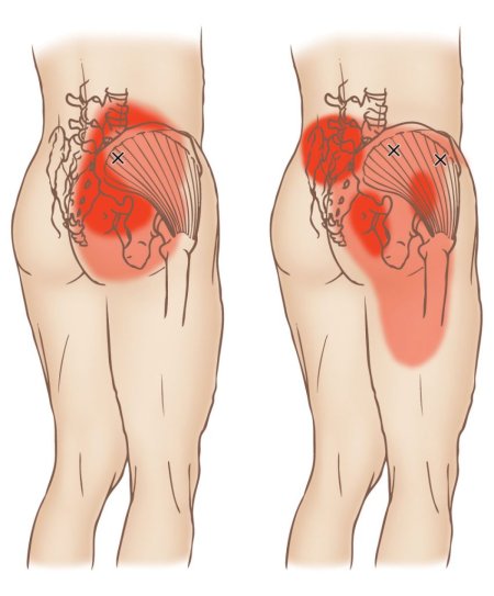 Анатомия ягодичных