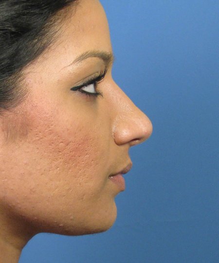 Нос с горбинкой