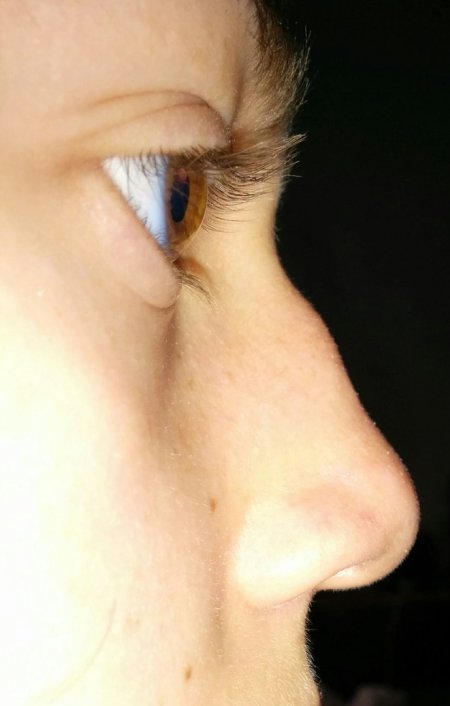 Нос с небольшой горбинкой