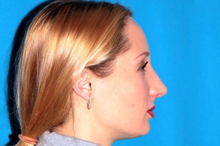 Большой нос с горбинкой