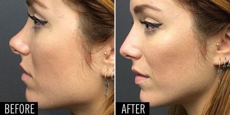 Большой нос с горбинкой