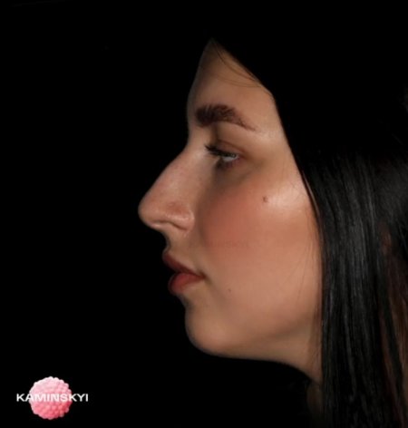 Римский нос с горбинкой