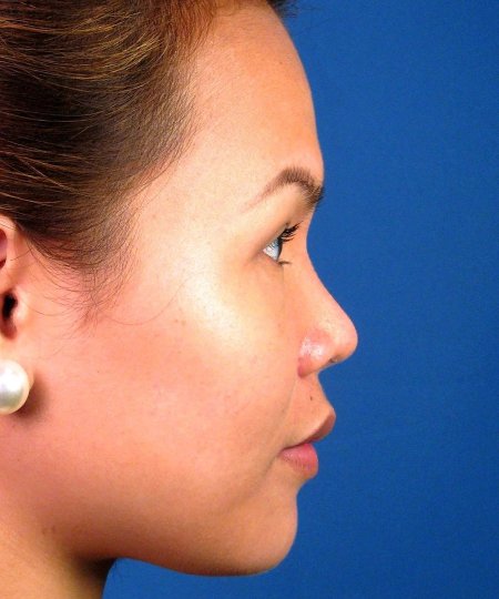 Курносый нос с горбинкой