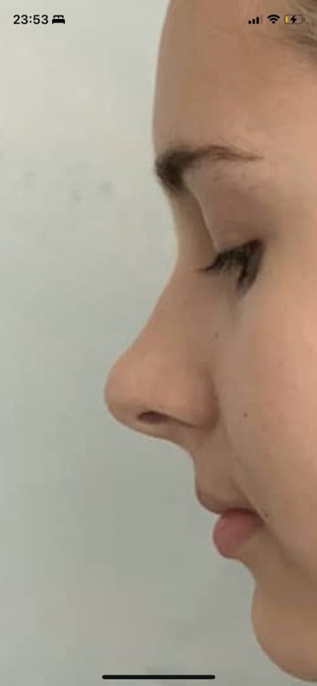 Нос горбинка