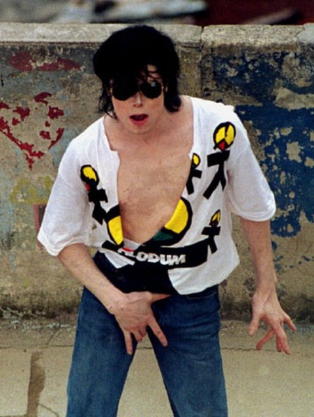 Майкл джексон витилиго