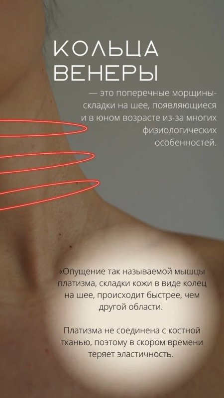 Кольца венеры