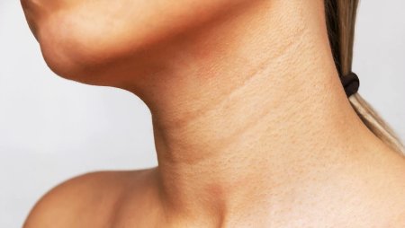 На шее кольца венеры