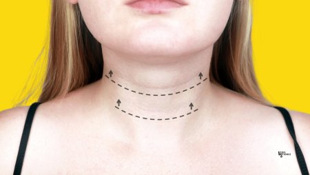 На шее кольца венеры