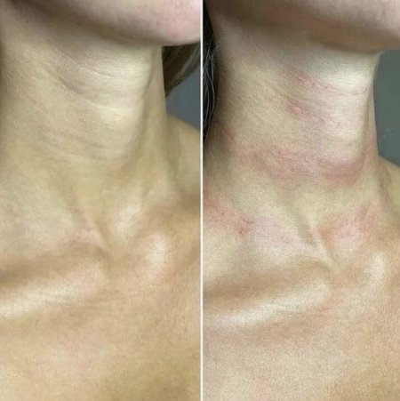 Кольца венеры