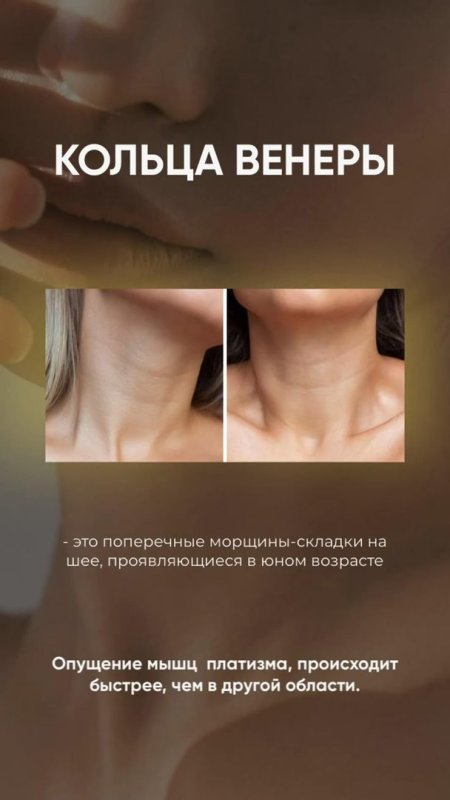 Кольца венеры