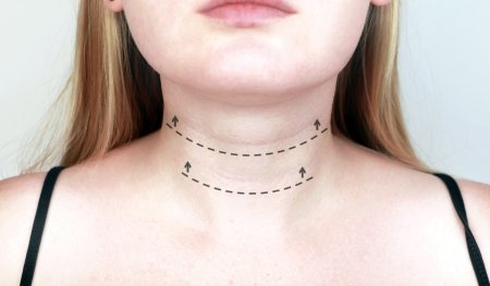 На шее кольца венеры