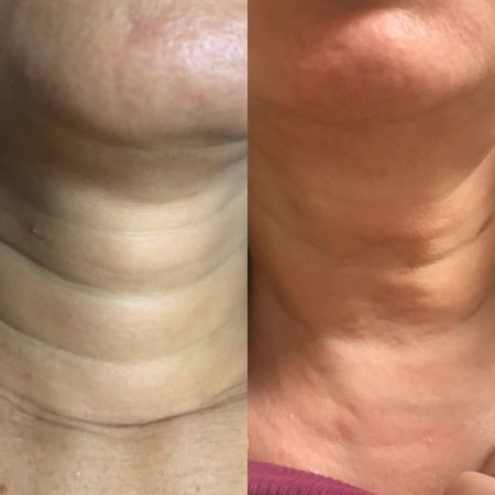 Холодная плазма кольца венеры