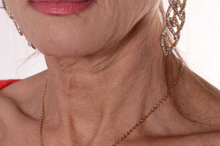 Морщины на шее