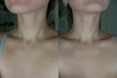 На шее кольца венеры