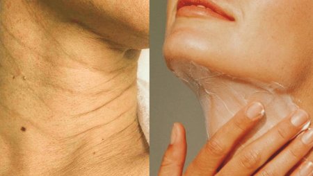 Морщины на шее