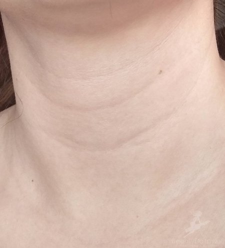 На шее кольца венеры