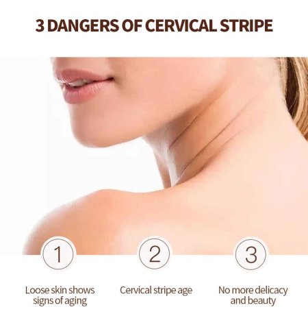 На шее кольца венеры