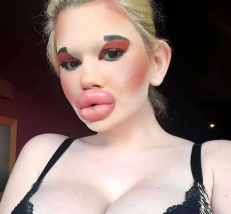 Самые большие силиконовые губы