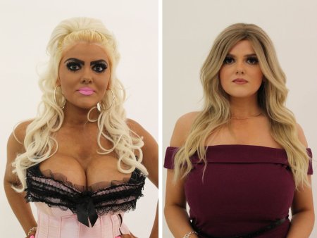 Девушки с пластическими операциями