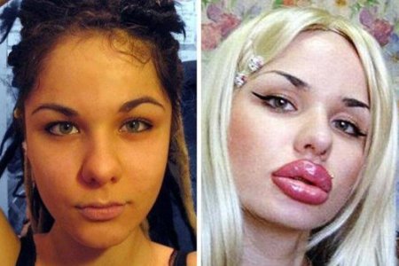 Кристина Рей до операции