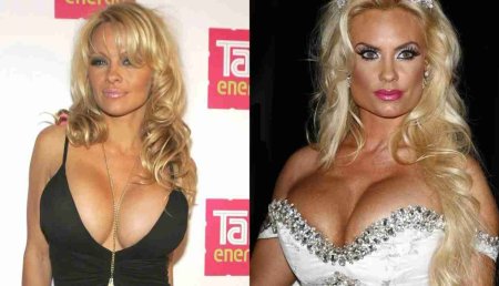 Пластическая операция на грудь