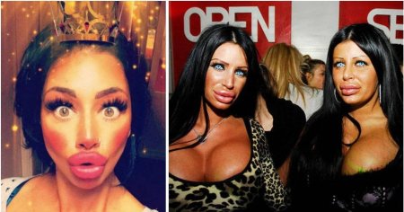 Неудачные пластические операции