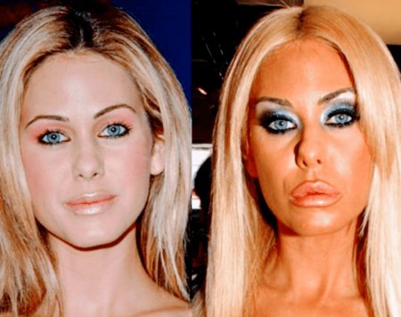 Шона сэнд до пластики