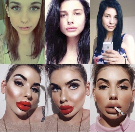 Девушки с пластическими операциями