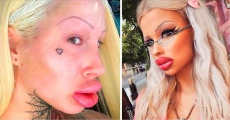 Силиконовые губы в старости