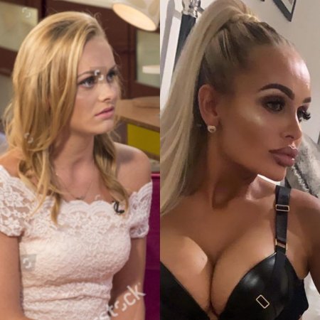 Неудачные пластические операции