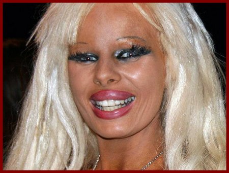 Жертвы пластических операций