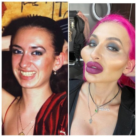 Девушка с самыми большими скулами