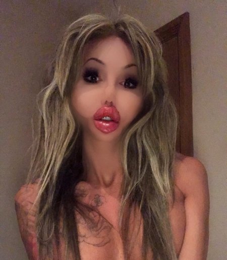 Сэмми Льюис до пластики