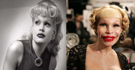 Аманда лепор до и после операции