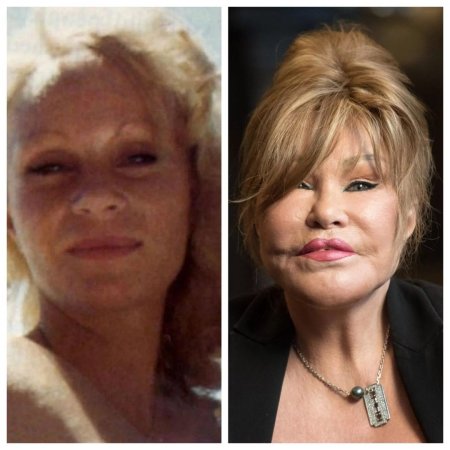 Джослин вильденштейн в молодости до операции