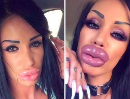 Девушки с накаченными губами красивые