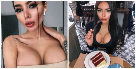 Алена Омович до пластики