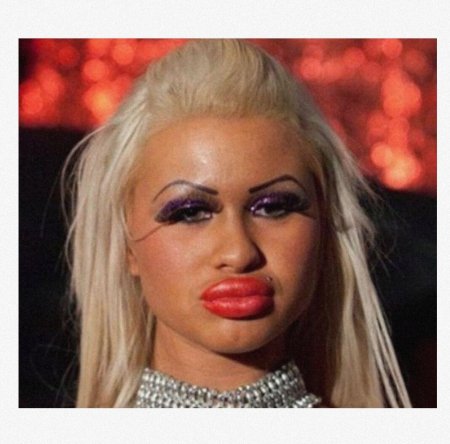 Огромные перекаченные губы