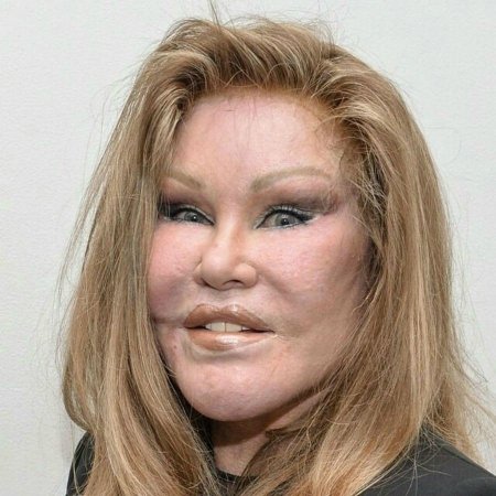 Вильденштейн джослин