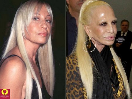 Donatella Versace до пластики