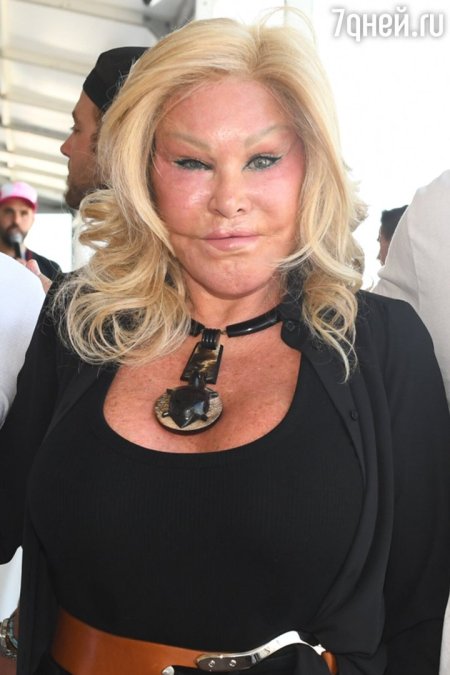 Джоселин вильденштейн